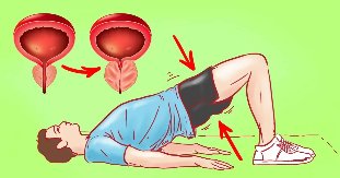 Exercise for prostatitis